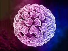 ʲôͷ(HPV)-lni