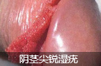 ʲôͷ(HPV)-lni